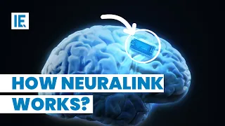 Elon Musk’s Neuralink gets FDA Approval: See How It Works