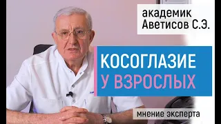 Косоглазие у взрослых. Лечение косоглазия с операцией и без. Интервью с академиком Аветисовым С.Э.