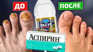 Тайное оружие фармацевтов от грибка ногтей! Уксус и аспирин