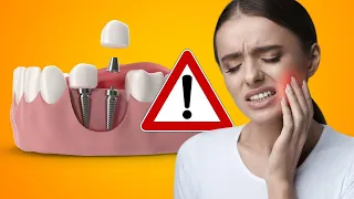 EVERYONE WANTS TO KNOW: Will Dental Implants Hurt?