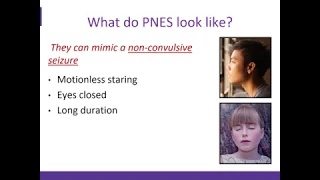 An Overview of Psychogenic Non Epileptic Seizures (PNES)