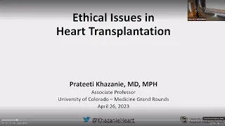 Don't Hate the Player, Hate the Game: Ethical Challenges in Heart Transplantation