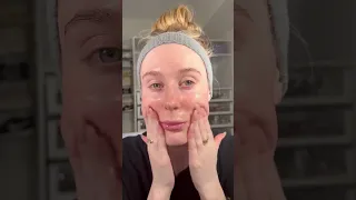 6 Months of Tretinoin: Dry, Sensitive, Eczema-Prone Skin Transformation!