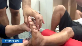 Manobras para o tratamento do Neuroma de Morton