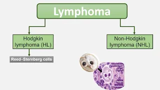 Approach to patient with lymphadenopathy