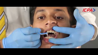 How to Use Orthodontic And Interdental Toothbrushes With Braces