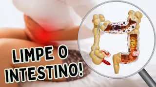 COMO ESTÁ O SEU COCÔ? SEU INTESTINO PODE ESTAR INFLAMADO! | Dr Dayan Siebra