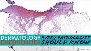 Dermatology Emergencies Every Pathologist Should Know