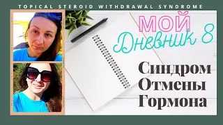 8.Дневник:Синдром Отмены Гормональной мази. Дерматилломания - Как перестать ковырять лицо?