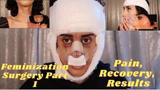 MTF Feminization Facial Surgery Part 1 (graphic)