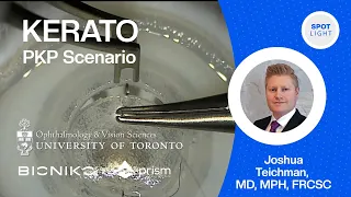 BIONIKO | SURGEON SPOTLIGHT - JOSHUA TEICHMAN  | CORNEAL TRANSPLANT (PKP) SCENARIO WITH KERATO