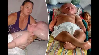 Woman in the body of a huge baby