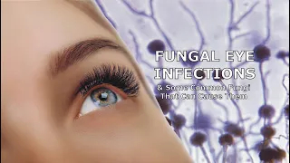 Fungal Eye Infections and Some Common Fungi That Can Cause Them