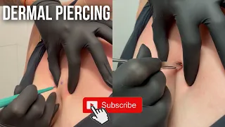 This Is For You If You Want a DERMAL PIERCING! 💎