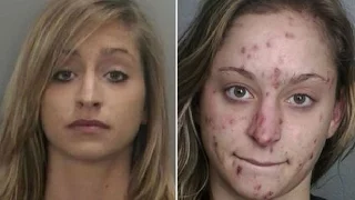 41 Crystal Meth Before & After Photos & its Devastating Effects.