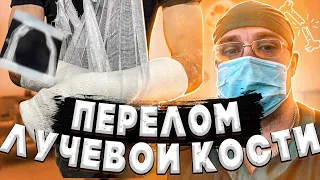 ПЕРЕЛОМ ЛУЧЕВОЙ КОСТИ | Репозиция, Гипс, Разработка Лучезапястного Сустава