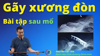 Tập vật lý trị liệu SAU MỔ GÃY XƯƠNG ĐÒN đơn giản tại nhà | Khớp Việt Official