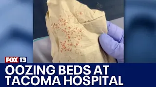 Oozing beds discovered at Tacoma hospital | FOX 13 Seattle