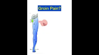 Groin Pain