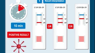 The COVID-19 blood screening test