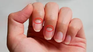 The Moons on Your Nails Reveal This About Your Health