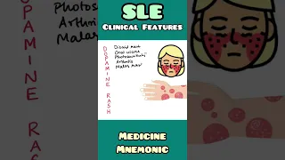 Systemic Lupus Erythematosus (SLE) : Clinical Features - mnemonic | Rheumatology | #shorts
