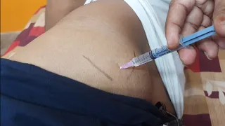 IM इंजेक्शन देने का सही तरीका | Easy steps to give Intramuscular injection | IM injection technique