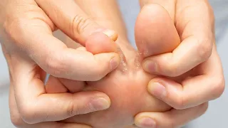 Средство от грибка ногтей с алиэкспресс 🔔 Лекарство от грибка ногтей лак