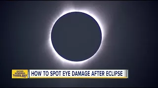 Solar eclipse: Eye damage can show later