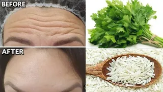 Anti-wrinkle mask, eliminates fine lines and wrinkles and fights their reappearance