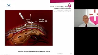 Moderne Therapie der Stuhlinkontinenz