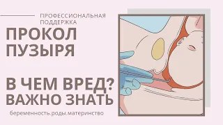 Прокол ПУЗЫРЯ в РОДАХ/АМНИОТОМИЯ/Околоплодный пузырь