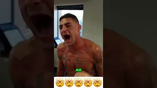 Diego Sanchez getting EXCRUCIATING UFC therapy 😂😂🥊