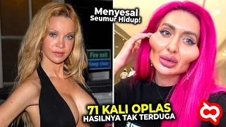 Niat Lebih Cantik Tapi Malah Alami Hal Terduga! Artis Cantik ini Menyesal Seumur Hidup Gagal Operasi