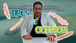 Tipos de cicatrices - Dr. Andrés Callejas