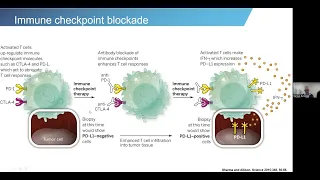 OICR Mondays: 'Immuno-oncology — moving beyond the asymptote'