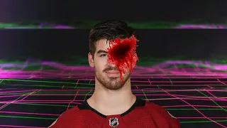 Conor Garland takes a puck to the face and dies [EMOTIONAL]