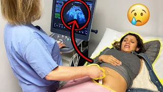 UNEXPECTED NEWS At The BABY CHECK UP! **WE CAN'T BELIEVE IT** | The Royalty Family