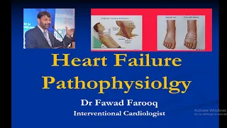 Heart Failure Management.English Dr.Fawad Farooq