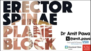 Erector Spinae Plane Block - RA-UK Webinar version