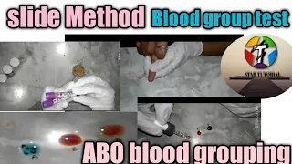 Slide technique blood group test ll ABO Blood grouping ll Chapter-7