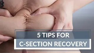 5 Tips For C-Section Recovery