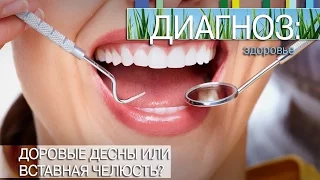 Здоровые десны или вставная челюсть? | Диагноз: здоровье [21/15]