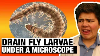 DRAIN FLY LARVAE UNDER A MICROSCOPE (Clogmia Albipunctata) | Microscope Monday