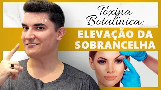 Botox® | Toxina Botulínica: Elevação da Sobrancelha #botox