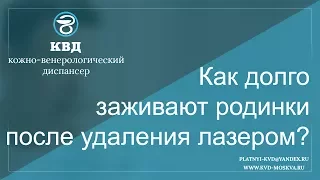 267  Как долго заживают родинки после удаления лазером?