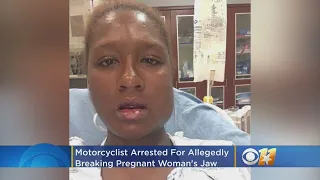 Road Rage: Motorcyclist Arrested For Allegedly Breaking Pregnant Woman’s Jaw