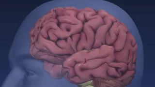 Frontotemporal Dementia