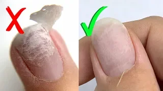 Mistakes in Gel Manicure Removal | Avoid Nail Damage