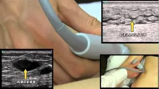 Soft Tissue Ultrasound from One Minute Ultrasound